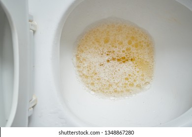 119 Urine bubble Stock Photos, Images & Photography | Shutterstock