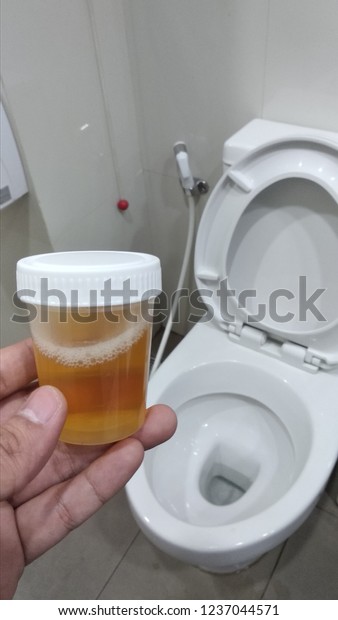 Download Yellow Urine Sample Round Plastic Bottle Stock Photo Edit Now 1237044571 Yellowimages Mockups