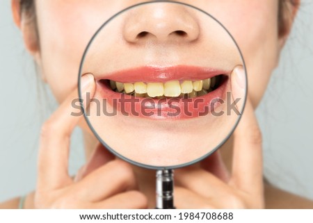 The yellowed teeth of a woman are enlarged with a loupe.