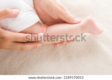 Young adult mother finger applying white medical ointment on newborn bare leg. Red rash on skin. Allergy from milk formula or mother milk. Care about baby body. Closeup. Top view.