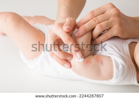 Young adult mother finger applying white medical ointment on newborn arm. Red rash on skin. Allergy from milk formula or mother milk. Care about baby body. Closeup. Side view.