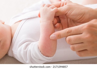 Young adult mother finger pointing to newborn arm with red rash. Allergy from milk formula or mother milk. Baby skin problem. Closeup. Side view. - Shutterstock ID 2171394857