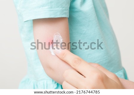 Young adult mother fingers applying white moisturizing cream on toddler girl arm after red bite of mosquito. Isolated on light gray background. Care about children body skin. Closeup. Side view.