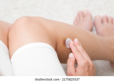 Young Adult Woman Fingers Applying White Medical Ointment On Bruise On Leg Skin. First Aid. Self Help. Closeup. Point Of View Shot.