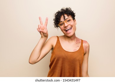 Young African American Woman With Skin Birth Mark Showing Victory Sign And Smiling Broadly.