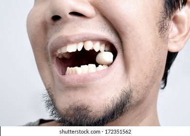 young asian man cracking a nut by his teeth
