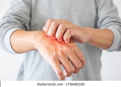Young asian man itching and scratching on hand from itchy dry skin eczema dermatitis