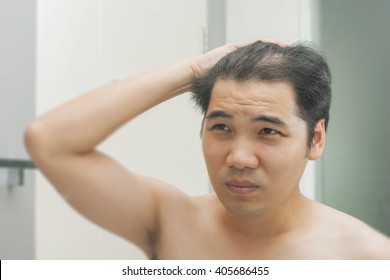 Young Asian Man Standing In Front Of Mirror Concerned By Hair Loss
