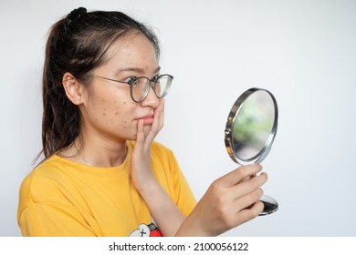 Young Asian woman feeling shock while looking acne and scar occur on face by mini mirror. Conceptual shot of Acne and Problem Skin on female face.