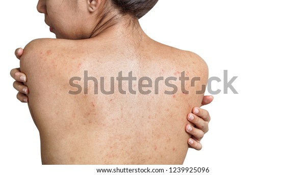 Image Shutterstock Com Image Photo Young Asian