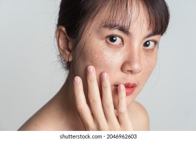 Young Asian woman worry with freckle on face and hand gently touching cheek applying skincare cosmetics treatment.