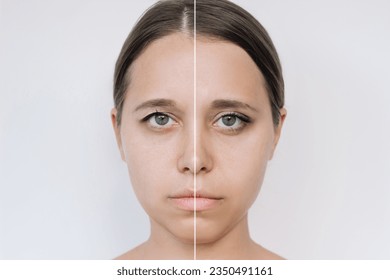 Young attractive caucasian woman's face with drooping upper eyelid before and after blepharoplasty isolated on a gray background. The result of plastic surgery. Changing the shape, cut of the eyes