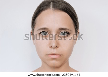 Young attractive caucasian woman's face with drooping upper eyelid before and after blepharoplasty isolated on a gray background. The result of plastic surgery. Changing the shape, cut of the eyes