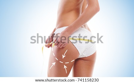 Young attractive woman with arrows along her buttocks measures her body over blue background. Fat lose, diet, cellulite removal, liposuction, healthy life-style concept. 