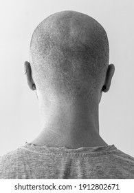 2,586 Bald teenager Images, Stock Photos & Vectors | Shutterstock