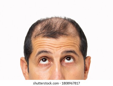 Young bald man  over white isolated background looking up sad, upset, unhappy and depressed.