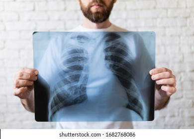 Young bearded man holding X-ray film of lungs and heart in front of his chest, white background - Shutterstock ID 1682768086