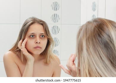 Young Beautiful Caucasian Blonde Woman Looking In The Bathroom Mirror At Her Eyes With Dark Circles Under The Eyes. Bruises Are Caused By Insomnia, Fatigue, Nervousness, Lack Of Sleep And Stress