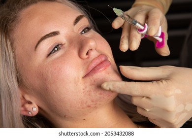 
Young beautiful caucasian woman receiving esthetic injections. Lip filler beauty procedures. Plump lips, russian lips, derma injections, full lips.  - Shutterstock ID 2053432088