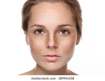 Young Beautiful Freckles Woman Face Portrait With Healthy Skin