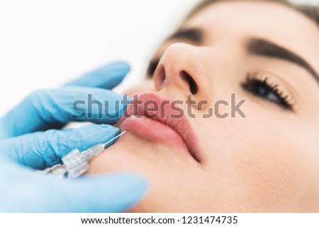 Young beautiful woman having hyaluron fillers done on counture of her lips.