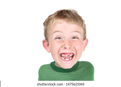 Young Boy Being Silly Showing His Missing Teeth