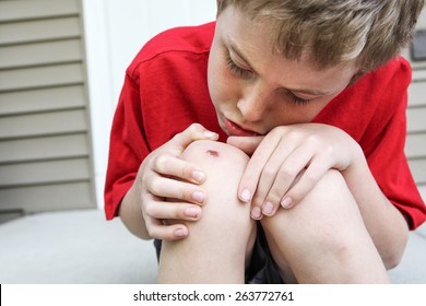 Young Boy Examining A Scraped Knee