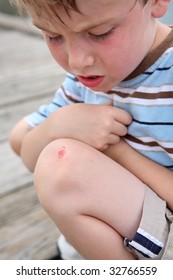 Young Boy With A Scraped Knee