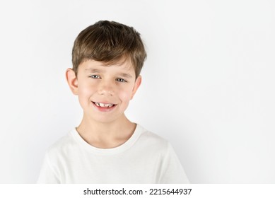 A Young Boy Smiles Nicely On A Light Background, The Boy Has A Nice Smile But Not All His Teeth Are Healthy, His Teeth Are Decaying From Sweets, He Needs To Go To The Dentist, Dental Concept