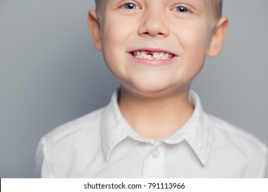 A Young Boy Smiling With A Missing Tooth