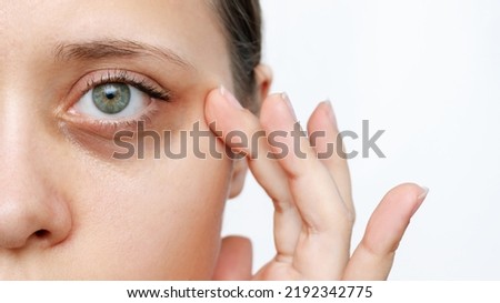 A young caucasian woman demonstrating dark circles under her eyes with hand isolated on a white background. Pale skin, bruises under the eyes are caused by fatigue, lack of sleep, insomnia and stress