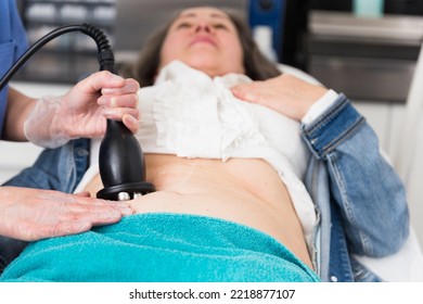 Young Cosmetology Doctor Working In The Clinic Gives An Elderly Female Client A Vacuum Abdominal Massage. Close-up Image..