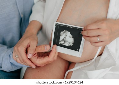 Young couple holding a snapshot of the future ultrasound of the child. Pregnancy concept. Pregnant girl. Hands of young parents. Russia, St. Petersburg, 03.03.2021