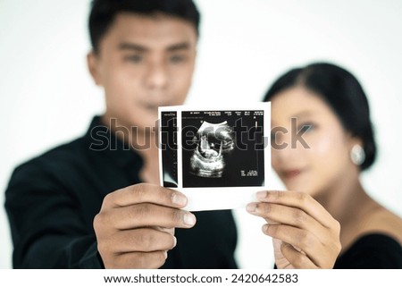 Young couple shows ultrasound image of their baby, focus on ultrasound image