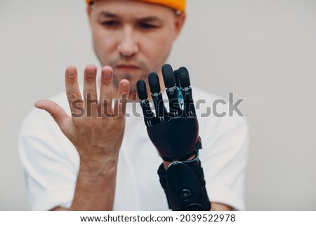 Young disabled man checking and looking on artificial prosthetic hand and compare with healthy hand