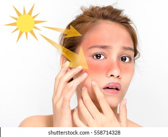 Young Female With A Bad Sunburn On Her Face