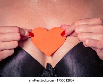 bra marks on chest