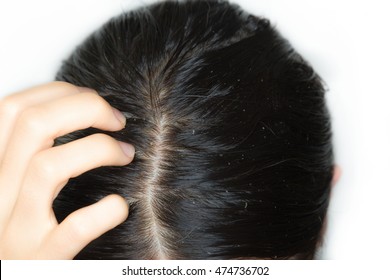 Greasy Hair Woman Images Stock Photos Vectors Shutterstock