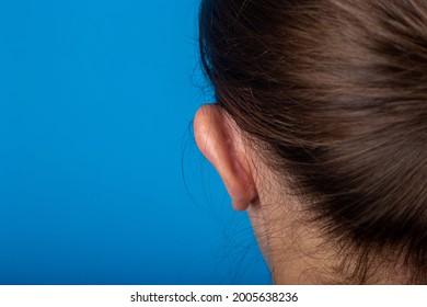 Young Girl Paw-eared Ear Back View On A Blue Background. Otoplasty, Surgery.