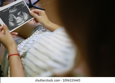 A young girl thinking about abortion after getting known about female pregnant state. She's looking at ultrasound photo with hesitation