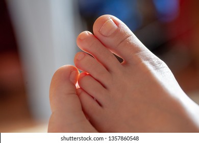 young girl's toes are healthy and beautiful. Well-groomed toes. Concept for medical articles and ointments - the image of the toes and feet. Image of legs with space for inscriptions and advertising. - Shutterstock ID 1357860548