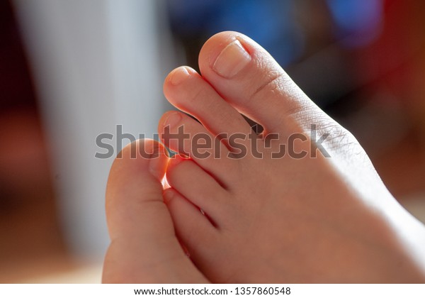 young girl\'s toes are healthy and beautiful.\
Well-groomed toes. Concept for medical articles and ointments - the\
image of the toes and feet. Image of legs with space for\
inscriptions and\
advertising.