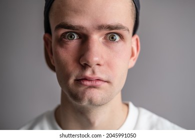 Young guy with bulging eyes, shock, surprise.