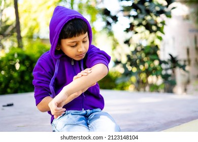 Young Indian Kid Itching Skin Or Rashes At Park - Concept Of Skincare, Allergy, Winter Infecton And Medical