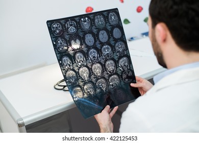 Young Male Physician Reading And Reviewing A MRI Brain Scan