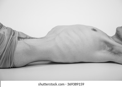 Young Man With Anorexia Nervosa Problem. White Background.