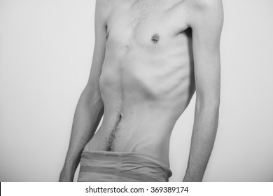 Young Man With Anorexia Nervosa Problem. White Background.