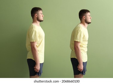 Young man with bad and proper posture on color background