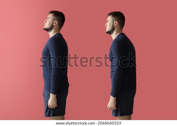 Young\
man with bad and proper posture on color\
background