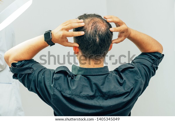 A young man with a bald spot\
in the office of a trichologist cosmetologist. Bald on a man\'s\
head. Male pattern baldness. Fighting hair loss in\
men.